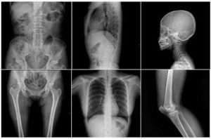 radiology musculoskeletal serba